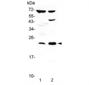Western blot testing of 1) rat brain and 2) human PANC-1 lysate with TRFP antibody at 0.5ug/ml. Predicted molecular weight ~23 kDa.