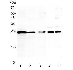 Western blot testing of 1) human Jurkat, 2) human K562, 3) human Raji, 4) rat thymus and 5) mouse thymus lysate with IL-36 alpha antibody at 0.5ug/ml. Predicted molecular weight ~17 kDa, routinely observed at 18-22 kDa.