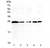 Western blot testing of 1) human Jurkat, 2) human K562, 3) human Raji, 4) rat thymus and 5) mouse thymus lysate with IL-36 alpha antibody at 0.5ug/ml. Predicted molecular weight ~17 kDa, routinely observed at 18-22 kDa.