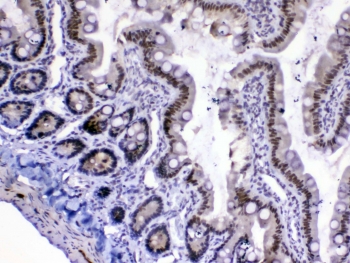 IHC testing of FFPE rat small intestine tissue with MED18 antibody at 1ug/ml. Required HIER: steam section in pH6 citrate buffer for 20 min and allow to cool prior to testing.