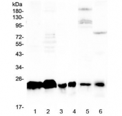 Western blot testing of human 1) A431, 2) K562, 3) U-2 OS, 4) HL60, 5) rat liver and 6) mouse kidney lysate with MED18 antibody at 0.5ug/ml. Predicted molecular weight ~24 kDa.