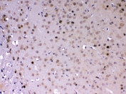 IHC testing of FFPE mouse brain tissue with MED18 antibody at 1ug/ml. Required HIER: steam section in pH6 citrate buffer for 20 min and allow to cool prior to testing.