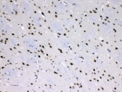 IHC testing of FFPE rat brain tissue with MED18 antibody at 1ug/ml. Required HIER: steam section in pH6 citrate buffer for 20 min and allow to cool prior to testing.