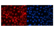 Immunofluorescent staining of FFPE human A431 cells with MED18 antibody (red) and DAPI (blue). Required HIER: steam section in pH6 citrate buffer for 20 min and allow to cool prior to testing.