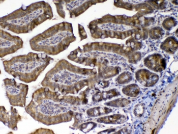 IHC testing of FFPE mouse small intestine tissue with MED9 antibody at 1ug/ml. Required HIER: steam section in pH6 citrate buffer for 20 min and allow to cool prior to testing.