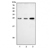 Western blot testing of human 1) Jurkat, 2) HL60 and 3) ThP-1 cell lysate with Bcl-2 antibody at 0.5ug/ml. Predicted molecular weight ~26 kDa.