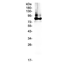 Western blot testing of human plasma lysate with Prothrombin antibody at 0.5ug/ml. Predicted molecular weight ~70 kDa, observed here at ~85 kDa.