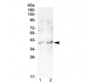 Western blot testing of human 1) Jurkat and 2) MCF7 cell lysate with CCR5 antibody at 0.5ug/ml. Predicted molecular weight ~41 kDa.