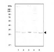 Western blot testing of 1) rat spleen, 2) mouse spleen, 3) mouse ANA-1, 4) mouse RAW264.7 and 5) mouse EL-4 cell lysate lysate with Il6 antibody at 0.5ug/ml. Predicted molecular weight ~24 kDa but may be observed at higher molecular weights due to glycosylation.