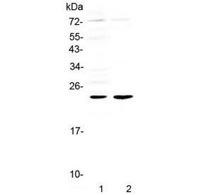 Western blot testing of 1) rat heart and 2) mouse heart tissue lysate with Il6 antibody at 0.5ug/ml. Predicted molecular weight ~24 kDa.~