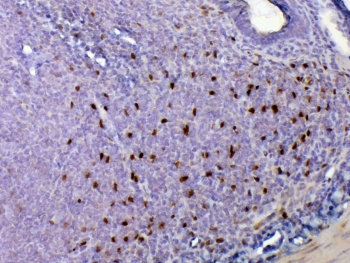 IHC testing of FFPE rat lymph tissue with Il33 antibody at 1ug/ml. Required HIER: steam section in pH6 citrate buffer for 20 min and allow to cool prior to testing.