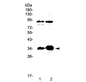 Western blot testing of rat 1) spleen and 2) lung tissue lysate with Il33 antibody at 0.5ug/ml. Predicted molecular weight ~31 kDa.
