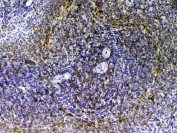 IHC testing of FFPE rat spleen tissue with Cd14 antibody at 1ug/ml. Required HIER: steam section in pH6 citrate buffer for 20 min and allow to cool prior to testing.