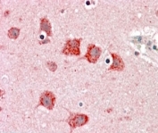 IHC staining of FFPE human cortex with DKK3 antibody at 5ug/ml. HIER: steamed with pH6 citrate buffer, AP-staining.