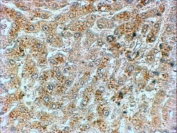 IHC staining of FFPE human liver with GADD34 antibody at 2ug/ml. HIER: steamed with pH6 citrate buffer, HRP-staining.
