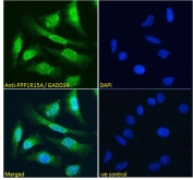 ICC/IF testing of fixed and permeabilized human HeLa cells with GADD34 antibody (green) at 10ug/ml and DAPI nuclear stain (blue).