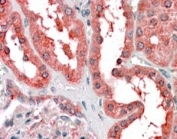 IHC testing of FFPE human kidney with Cyt19 antibody at 4ug/ml. HIER: steamed with pH6 citrate buffer, AP-staining.