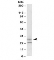 Western blot testing of human cerebellum lysate with FBXO44 antibody at 1.5ug/ml. Predicted molecular weight: ~26kDa.
