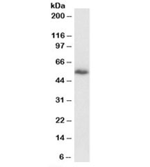 Western blot testing of NIH3T3 lysate with DBNL antibody at 1ug/ml. Predicted molecular weight: ~49kDa.