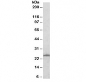 Western blot testing of A431 with RAN antibody at 0.5ug/ml. Predicted molecular weight ~25 kDa.
