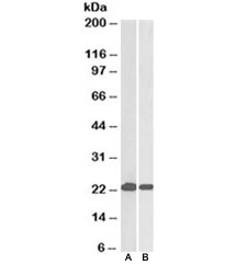 Western blot testing of HeLa [A] and Jurkat [B] lysates with DJ-1 antibody at 0.05ug/ml. Predicted molecular weight ~20kDa.