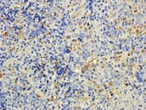 IHC staining of FFPE rat spleen with MTMR9 antibody at 5ug/ml. HIER: steamed with pH6 citrate buffer, DAB-staining.