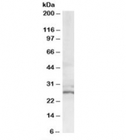 Western blot testing of HeLa lysate with TIP30 antibody at 0.6ug/ml. Predicted molecular weight: ~27/15/30kDa (isoforms 1/2/3).