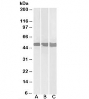 Western blot testing of Daudi [A], Jurkat [B] and HepG2 [C] lysates with DDX6 antibody at 0.3ug/ml. Predicted molecular weight: ~53kDa.