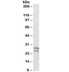 Western blot testing of human lymph lysate with BCL2 antibody at 0.1ug/ml. Expected molecular weight: ~26kDa (alpha) and ~22kDa (beta).