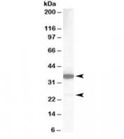 Western blot testing of human lung lysate with MCL1 antibody at 1ug/ml. Predicted molecular weight: 37/22 kDa (isoforms 1/3).