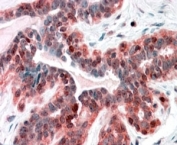 IHC testing of FFPE human breast with SNX12 antibody at 4ug/ml. HIER: steamed with pH6 citrate buffer, AP-staining.