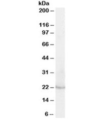 Western blot testing of human kidney lysate with Lipocalin 2 antibody at 0.03ug/ml. Predicted molecular weight ~22kDa.~