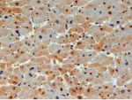 IHC testing of FFPE human heart with UBE2O antibody at 4ug/ml. HIER: steamed with pH6 citrate buffer, HRP-staining.