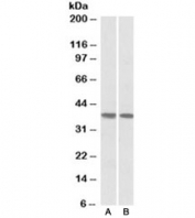 Western blot testing of human heart [A] and lung [B] lysates with KLF2 antibody at 1ug/ml. Predicted molecular weight ~37kDa.
