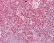 IHC testing of FFPE human thymus tissue with ELF1 antibody at 2.5ug/ml. Required HIER: steamed antigen retrieval with pH6 citrate buffer; AP-staining.