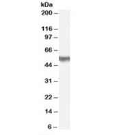 Western blot testing of H460 lysate with PACSIN3 antibody at 1ug/ml. Predicted molecular weight: ~48kDa.