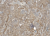 IHC staining of FFPE human kidney tissue with MRG15 antibody at 5ug/ml. Required HIER: steamed antigen retrieval with pH6 citrate buffer; HRP-staining.