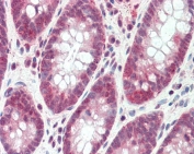 IHC testing of FFPE human colon tissue with SH2D3A antibody at 5ug/ml. Required HIER: steamed antigen retrieval with pH6 citrate buffer; AP-staining.