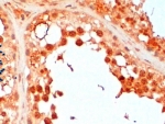 IHC testing of FFPE human testis with UBC3B antibody at 2ug/ml. HIER: steamed with pH6 citrate buffer, HRP-staining.