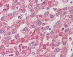 IHC staining of FFPE human liver with RANGAP1 antibody at 2.5ug/ml. HIER: steamed with pH6 citrate buffer, AP-staining.