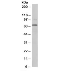Western blot testing of NIH3T3 lysate with RANGAP1 antibody at 0.2ug/ml. Predicted molecular weight: ~68kDa.~
