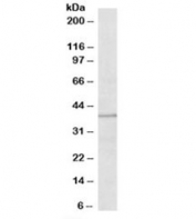 Western blot testing of human placenta lysate with TRIM5 antibody at 2ug/ml. Predicted molecular weight: ~56 kDa (isoform alpha), ~40 kDa (isoform gamma), ~38 kDa (isoform delta), ~31 kDa (isoform epsilon), ~30 kDa (isoform iota).