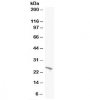 Western blot testing of A431 lysate with BAK1 antibody at 0.5ug/ml. Predicted molecular weight: ~23kDa.