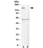 Western blot testing of human EBV-immortilized lymphoblastoid lysate with SIPA1 antibody at 1ug/ml, with (B) and without (A) immunizing peptide. Predicted molecular weight: ~112kDa but routinely observed at ~130kDa. It is observed here at ~150kDa.