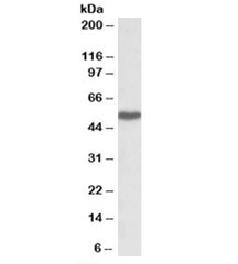Western blot testing of peripheral blood lymphocyte lysate with LSP1 antibody at 1ug/ml. Predicted molecular weight: ~37kDa but is routinely observed at ~52kDa (PMID: 15684321).