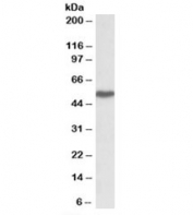 Western blot testing of peripheral blood lymphocyte lysate with LSP1 antibody at 1ug/ml. Predicted molecular weight: ~37kDa but is routinely observed at ~52kDa (PMID: 15684321).