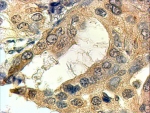 IHC testing of FFPE human prostate with SRD5A1 antibody at 4ug/ml. HIER: steamed with pH9 Tris/EDTA buffer, HRP-staining.