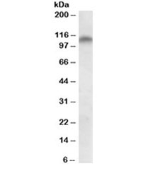 Western blot testing of human colon lysate with PLK4 antibody at 2ug/ml. Expected molecular weight ~110kDa.