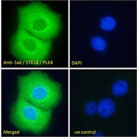Immunofluorescence staining of paraformaldehyde fixed human A431 cells, permeabilized with 0.15% Triton, using PLK4 antibody.