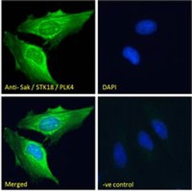 Immunofluorescence staining of paraformaldehyde fixed human HeLa cells, permeabilized with 0.15% Triton, using PLK4 antibody.